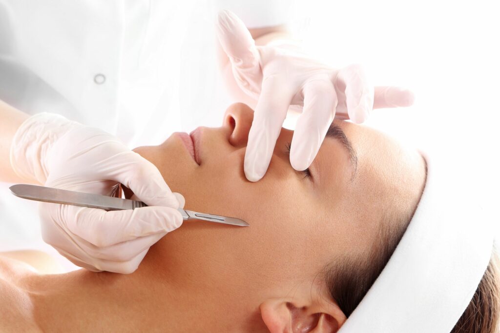 dermaplaning